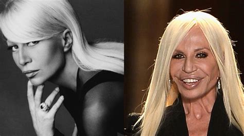 donatella versace antes de operarse